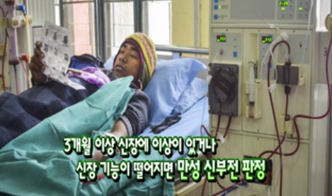 혈액투석을 위한 동정맥루