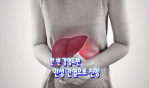 C형 간염