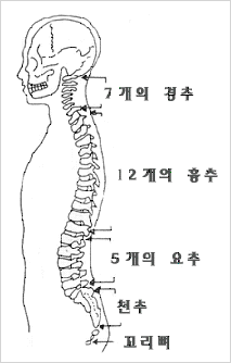 강직성 척추염 사진2